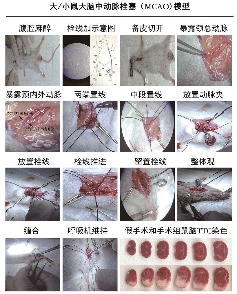 大 / 小鼠大腦中動脈栓塞 (MCAO) 模型